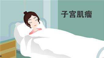 做宫腔镜视频,微创手术的精准视角